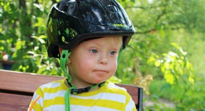 Dziecko z zespołem Downa